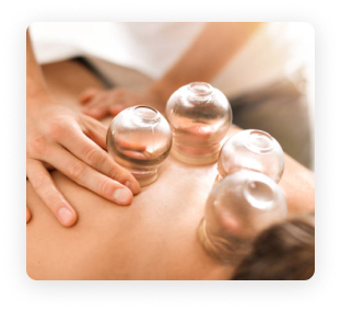 Cupping